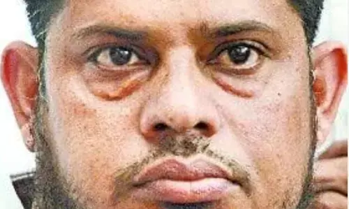 मीट व्यवसायी शकील कुरैशी के ठिकानों पर आयकर की छापेमारी