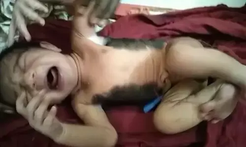 हरदोई में जन्में अनौखे बच्चे को देख डॉक्टर भी हुए हैरान, अब देखने वालों का उमड़ा हुजूम हरदोई में जन्में अनौखे बच्चे को देख डॉक्टर भी हुए हैरान, अब देखने वालों का उमड़ा हुजूम