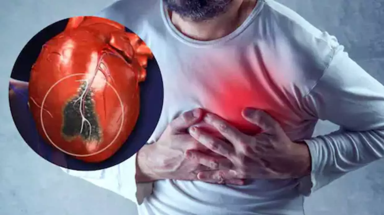 Cardiac arrest: क्यों बढ़ रहा है Heart Attack का खतरा! जानिए- किन लोगों को है कार्डियक अरेस्ट का अधिक खतरा, कैसे बचें? Cardiac arrest: क्यों बढ़ रहा है Heart Attack का खतरा! जानिए- किन लोगों को है कार्डियक अरेस्ट का अधिक खतरा, कैसे बचें?