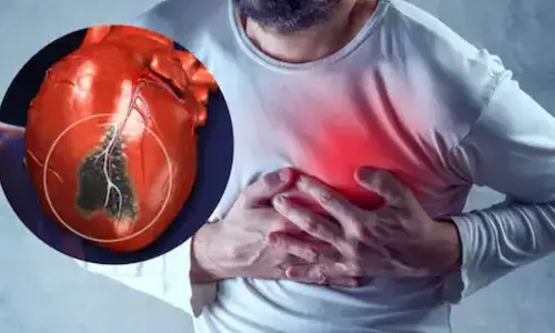 Cardiac arrest: क्यों बढ़ रहा है Heart Attack का खतरा! जानिए- किन लोगों को है कार्डियक अरेस्ट का अधिक खतरा, कैसे बचें? Cardiac arrest: क्यों बढ़ रहा है Heart Attack का खतरा! जानिए- किन लोगों को है कार्डियक अरेस्ट का अधिक खतरा, कैसे बचें?