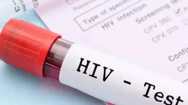 एचआईवी सेल्फ-टेस्ट बिना विलंब एड्स कार्यक्रम में शामिल हो