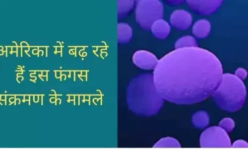 यूएस में आई नई बीमारी, यूएस के लोग हो गए चिंता में, जानिए कौन सी है यह बीमारी और क्या है इससे बचने के उपाय ?? यूएस में आई नई बीमारी, यूएस के लोग हो गए चिंता में, जानिए कौन सी है यह बीमारी और क्या है इससे बचने के उपाय ??