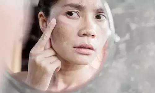 यह 4 फेस पर आएंगे आपके बहुत काम, चेहरे पर आएगी चमक और हट जाएंगे सारे दाग धब्बे, अपनाएं आप भी