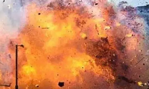 Ayodhya News: अयोध्या में हुआ तेज धमाका, काम कर रहे मजदूर का हाथ उड़ा Ayodhya News: अयोध्या में हुआ तेज धमाका, काम कर रहे मजदूर का हाथ उड़ा