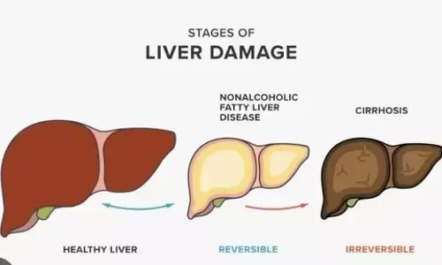 рдлреИрдЯреА рд▓реАрд╡рд░: рдХрд╛рд░рдг, рд▓рдХреНрд╖рдг, рдирд┐рджрд╛рди рдФрд░ рдЙрдкрдЪрд╛рд░ рдлреИрдЯреА рд▓реАрд╡рд░: рдХрд╛рд░рдг, рд▓рдХреНрд╖рдг, рдирд┐рджрд╛рди рдФрд░ рдЙрдкрдЪрд╛рд░
