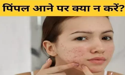 Pimples: अगर आपके भी चेहरे पर आते हैं मुंहासे तो ना करें यह गलतियां वरना बिगड़ जाएगा फिर Pimples: अगर आपके भी चेहरे पर आते हैं मुंहासे तो ना करें यह गलतियां वरना बिगड़ जाएगा फिर