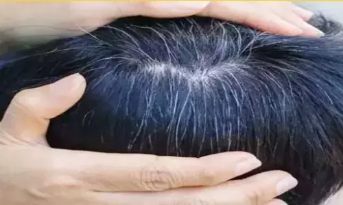 White Hair: आप के सर में भी अगर पहली बार दिखे सफेद बाल, तो जाने कैसे रोके इसकी ग्रोथ