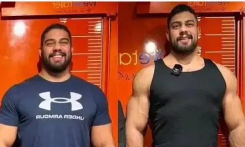 शख्स ने अपनी हाइट 7 इंच तक बढ़ाने के लिए खर्च किए  88 लाख रुपए जाने क्यों