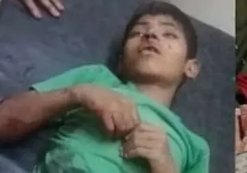 बरेली में आवारा कुत्तों के हमले से 11 साल के बच्चे की हुई मौत बरेली में आवारा कुत्तों के हमले से 11 साल के बच्चे की हुई मौत