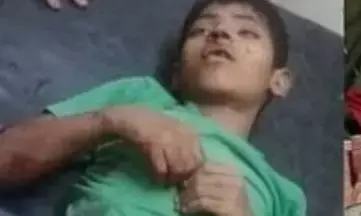 बरेली में आवारा कुत्तों के हमले से 11 साल के बच्चे की हुई मौत