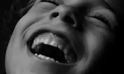 डॉक्टर रोज हंसने की सलाह क्यों देते हैं?