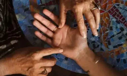 हस्तरेखा विज्ञान: आपके हाथ का यह चिन्ह आपको बना देगा अत्यंत धनवान हस्तरेखा विज्ञान: आपके हाथ का यह चिन्ह आपको बना देगा अत्यंत धनवान