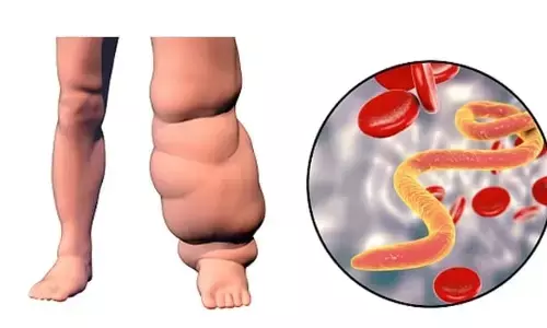 भारत में लिम्फैटिक फाइलेरियासिस पर जलवायु परिवर्तन का खतरनाक प्रभाव भारत में लिम्फैटिक फाइलेरियासिस पर जलवायु परिवर्तन का खतरनाक प्रभाव