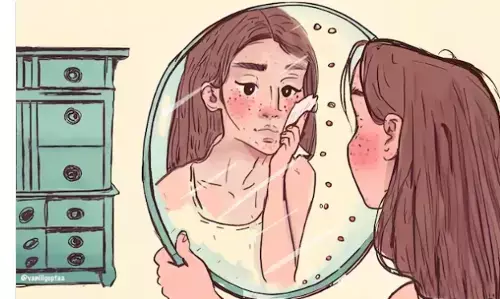 तैलीय त्वचा को नियंत्रित करने में आपकी मदद के लिए 8 उपाय