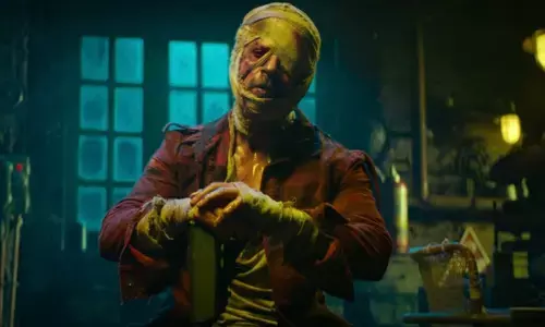 Shah Rukh Khan injures: शूटिंग के दौरान हादसे का शिकार हुए शाहरुख खान! करानी पड़ी सर्जरी