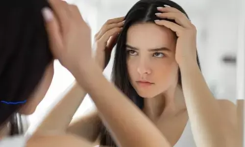 मानसून के मौसम में ऑयली स्कैल्प से कैसे बचें?