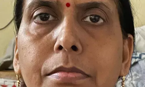 गाजियाबाद:पिता की पेंशन पर दावा करने वाली युवती का महिला अधिकारी पर हमला कर किया घायल