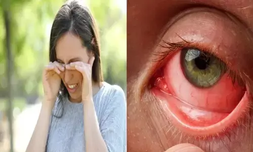 рдиреЗрддреНрд░ рдлреНрд▓реВ рд╡реГрджреНрдзрд┐ рдХреЗ рд▓рдХреНрд╖рдг, рдХрд╛рд░рдг, рдЙрдкрдЪрд╛рд░ рдиреЗрддреНрд░ рдлреНрд▓реВ рд╡реГрджреНрдзрд┐ рдХреЗ рд▓рдХреНрд╖рдг, рдХрд╛рд░рдг, рдЙрдкрдЪрд╛рд░