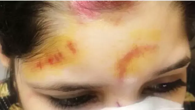 आईफोन छीनने की कोशिश के बीच दिल्ली की महिला टीचर ऑटो से गिरी आईफोन छीनने की कोशिश के बीच दिल्ली की महिला टीचर ऑटो से गिरी