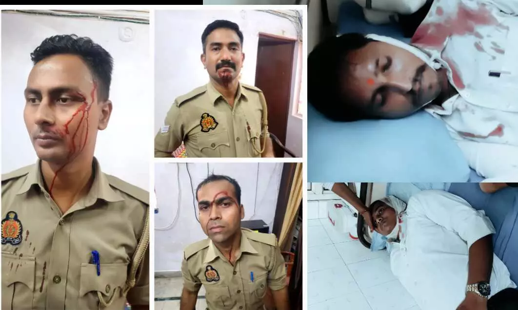 हापुड़ में पुलिस और वकीलों में तीखी झड़प, कई वकील और पुलिस कर्मी घायल