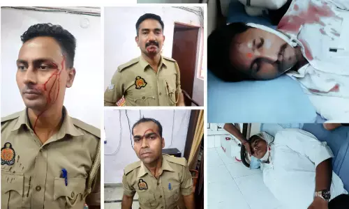 हापुड़ में पुलिस और वकीलों में तीखी झड़प, कई वकील और पुलिस कर्मी घायल हापुड़ में पुलिस और वकीलों में तीखी झड़प, कई वकील और पुलिस कर्मी घायल