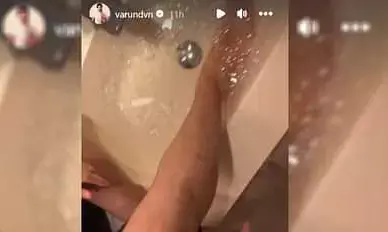 वीडी 18 की शूटिंग के दौरान चोटिल हुए वरुण धवन, फैंस के साथ साझा किया हेल्थ अपडेट वीडी 18 की शूटिंग के दौरान चोटिल हुए वरुण धवन, फैंस के साथ साझा किया हेल्थ अपडेट