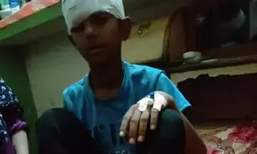 गाजियाबाद में कुत्ते ने दादा के पास जा रहे बच्चे को काटा गाजियाबाद में कुत्ते ने दादा के पास जा रहे बच्चे को काटा