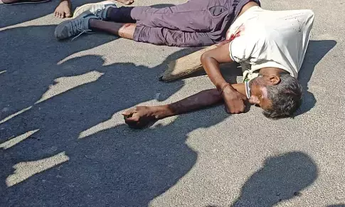 सहारनपुर दिल दहला देने वाला हादसा, पेट क़े आर पार हुआ लकड़ी का बरगा सहारनपुर दिल दहला देने वाला हादसा, पेट क़े आर पार हुआ लकड़ी का बरगा