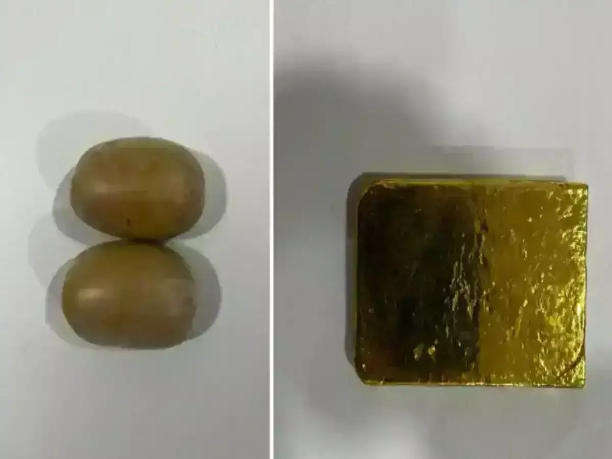 He brought gold worth Rs 38 lakh from UAE to India by hiding it in his stomach. Know how the young man was caught. He brought gold worth Rs 38 lakh from UAE to India by hiding it in his stomach. Know how the young man was caught.