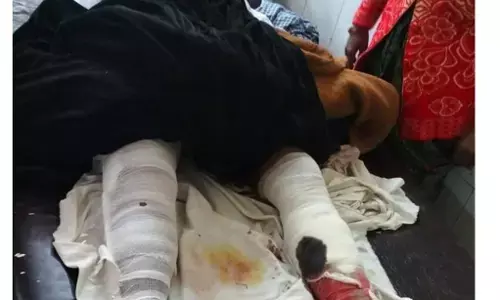 चुनावी रंजिश में प्रधान के ससुर पर फावड़े व कुल्हाड़ी से हमला कर किया मरणासन्न,हालत गम्भीर चुनावी रंजिश में प्रधान के ससुर पर फावड़े व कुल्हाड़ी से हमला कर किया मरणासन्न,हालत गम्भीर