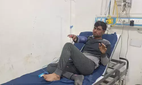 थाने में शराब नष्ट करते समय हादसा पुलिसकर्मी,दो चौकीदार झुलसे, हालत गंभीर