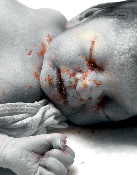 जिला अस्पताल में लापरवाही ने ली नवजात की जान, मॉर्च्युरी में शव को खाती रहीं चींटियां जिला अस्पताल में लापरवाही ने ली नवजात की जान, मॉर्च्युरी में शव को खाती रहीं चींटियां