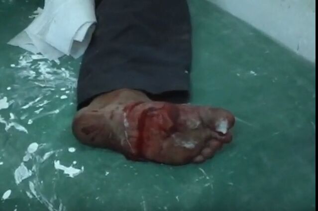 नॉएडा के बाद सुल्तानपुर में इनकाउंटर पर उठा सवाल, क्या यादव होने पर गोली मारी गई?