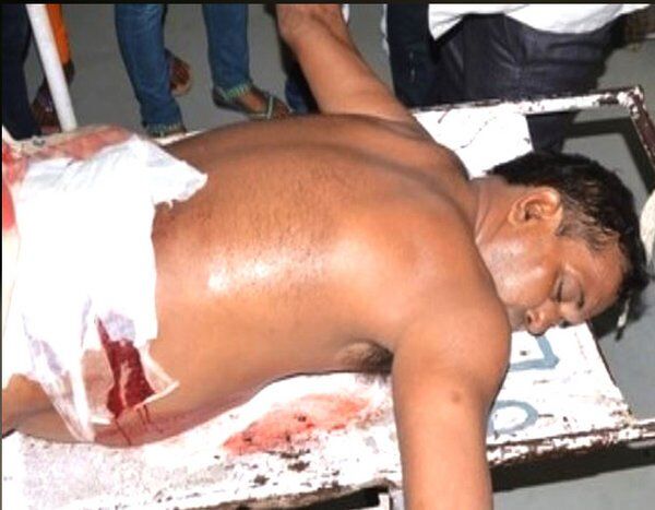 महाकवि निराला के प्रपौत्र पर गोली और बम से हमला, मौत