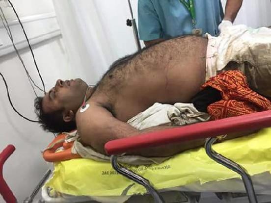 यमुना एक्सप्रेस-वे पर अमित जानी की गाड़ी का एक्सीडेंट, एक की मौत तीन घायल यमुना एक्सप्रेस-वे पर अमित जानी की गाड़ी का एक्सीडेंट, एक की मौत तीन घायल