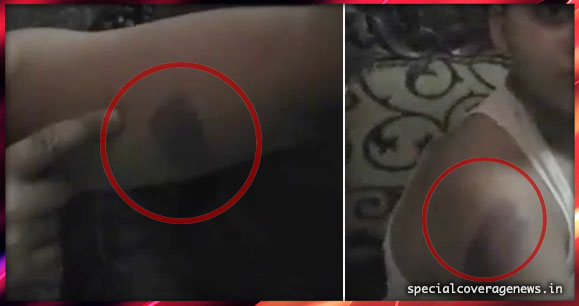 यूपी : अध्यापक ने बेरहमी से पीटा, छात्र हुआ बेहोश यूपी : अध्यापक ने बेरहमी से पीटा, छात्र हुआ बेहोश