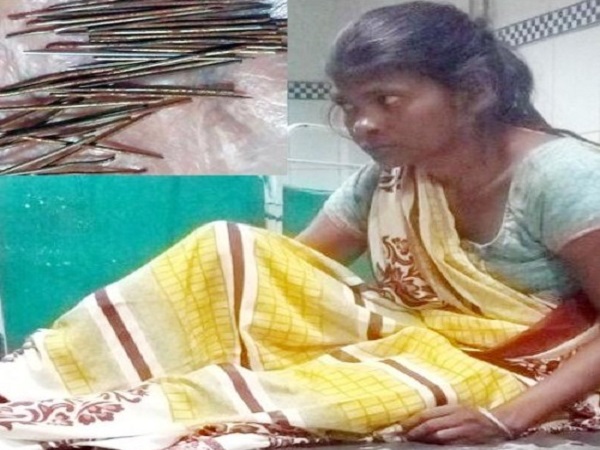 OMG: इस लड़की के पैरों से रोजाना निकल रही लोहे की कीलें, डॉक्टर भी हैं हैरान OMG: इस लड़की के पैरों से रोजाना निकल रही लोहे की कीलें, डॉक्टर भी हैं हैरान