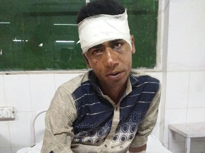 यूपी में रेप से बचने के लिए युवती ने आरोपी का काट डाला लिंग और फिर .... यूपी में रेप से बचने के लिए युवती ने आरोपी का काट डाला लिंग और फिर ....