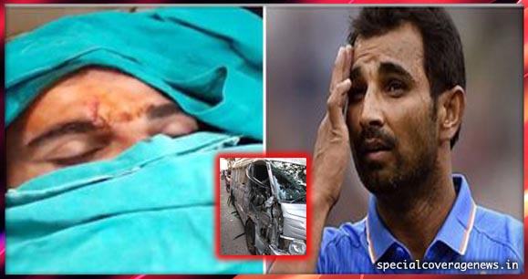 सड़क हादसे के शिकार हुए मोहम्मद शमी, सिर में लगे हैं कई टांके!