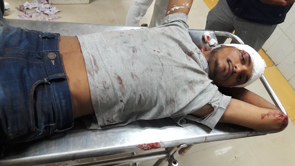 बीएचयू: छात्र गुट भिड़े, चली गोली बीएचयू: छात्र गुट भिड़े, चली गोली