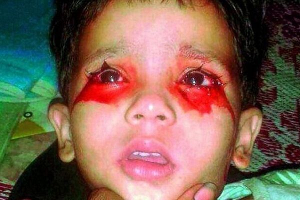 खून के आंसू रोती है ये मासूम, डॉक्टर भी हैरान, पिता ने PM मोदी से मांगी मदद