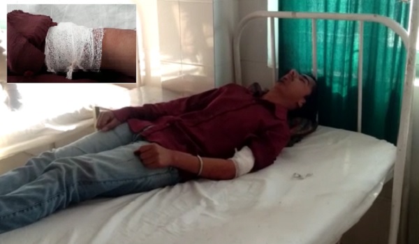 मामूली कहासुनी को लेकर ट्यूशन पढ़ने गए छात्र ने छात्र को चाकुओं से गोदा