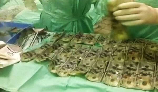 पति को सबक सिखाने के लिए पत्नी ने निगली 4 लाख रुपए के नोट