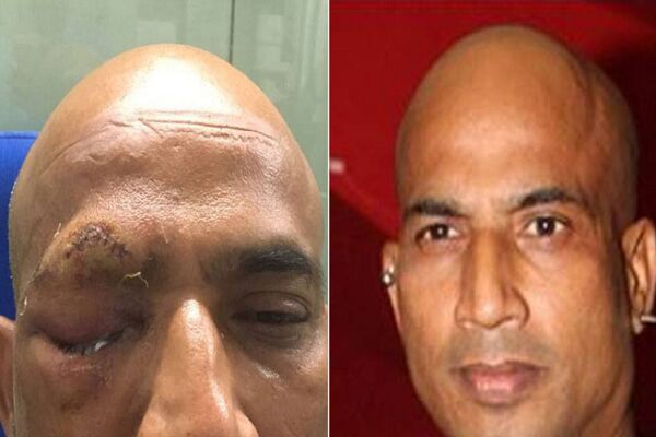 बॉलीवुड actor जीतू वर्मा पर राजस्थान में हुआ हमला, जा सकती है आंख की रोशनी