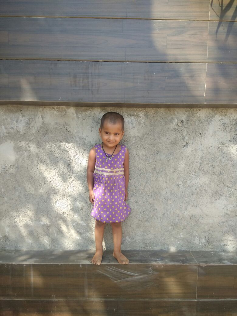 गाजियाबाद: इस मासूम गुड़िया को कुत्तों ने नौंच खाया