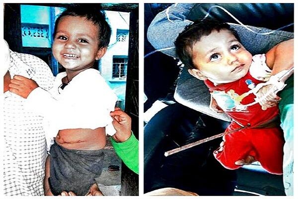 मासूम के पेट में घुसी लोहे की रॉड, बच्ची की हिम्मत देख डॉक्टर भी हैरान