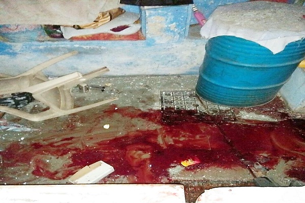 ट्रांजिस्टर ऑन करते ही हुआ जोरदार विस्‍फोट, उड़ गया अधेड़ आदमी के शरीर के चिथड़े