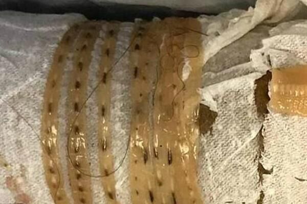 एक शख्स रोज खाता था मछली , जानिए फिर क्या हुआ