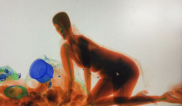 VIDEO: जब X-Ray मशीन के अंदर घुस गई लड़की, वजह जानकर आप भी हो जाएंगे हैरान