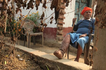 किसानों को खुशहाल बनाना है तो उन्हें विकलांग बनाने वाली बीमारी फाइलेरिया से मुक्ति दिलानी होगी